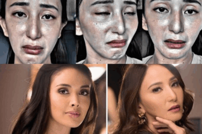 OMG! What Happened to Katrina Halili’s Face? Shocking Photos Go Viral